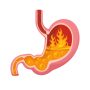 Acid reflux or heartburn.